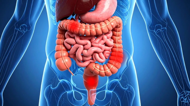 Nguyên nhân có thể do khối u phát triển làm thay đổi thói quen đi tiêu