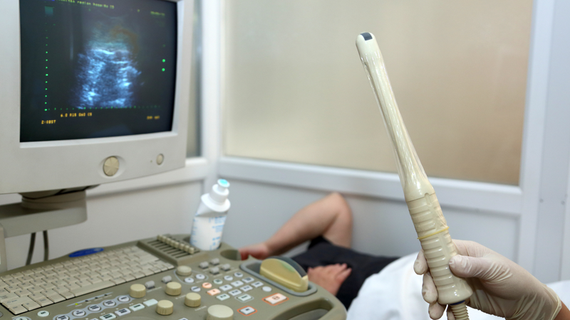 Phổ biến nhất là siêu âm qua ngã âm đạo