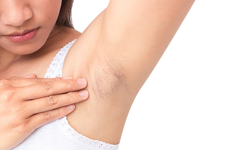 Mẹ bầu sau sinh bao lâu thì được nhổ lông nách? 1