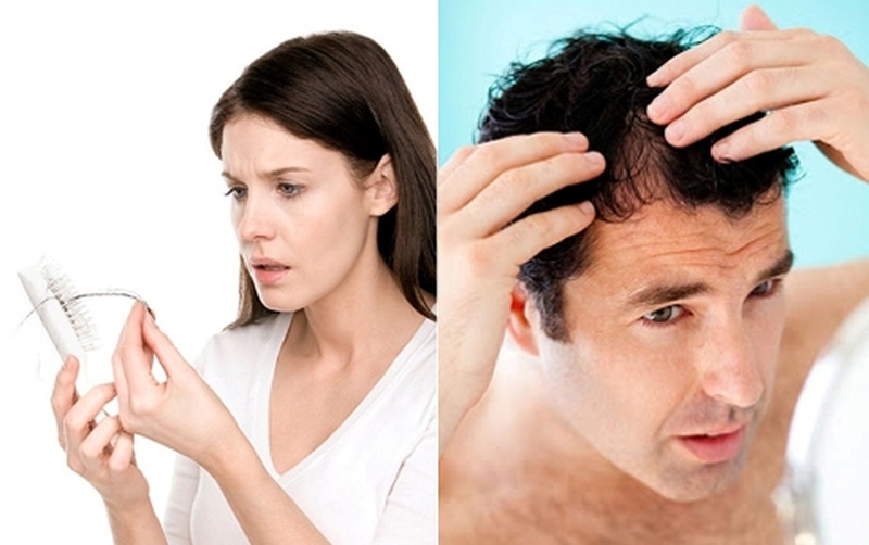 Rụng tóc có thể xảy ra ở cả nam và nữ