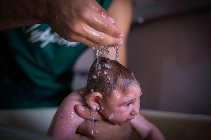 8 nguyên nhân gây tật đầu nhỏ và cách kiểm soát bệnh hiệu quả 3