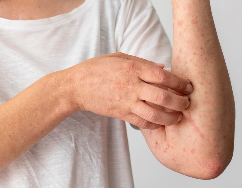 8 phương pháp phổ biến nhất trong điều trị ung thư da có thể bạn chưa biết 3