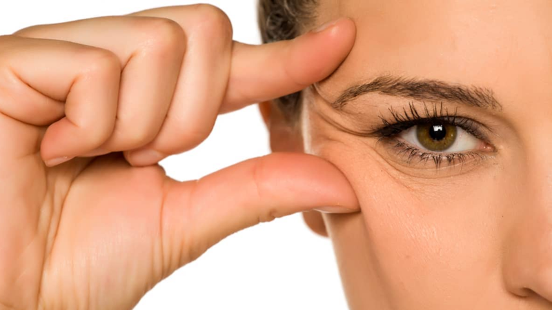 8 tác hại không ngờ của stress đến làn da của bạn 2