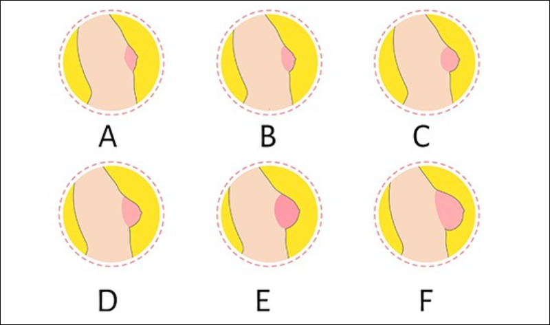 Cup ngực ABC là gì? Phân loại những cup ngực này như thế nào? 1