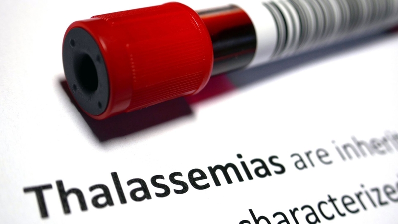 Thalassemia là một trong 9 bệnh di truyền gen lặn