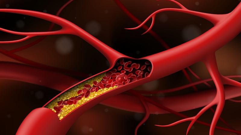 9 lợi ích của rau arugula đối với sức khỏe 3