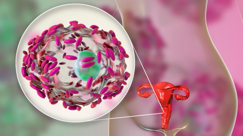 9 lý do khiến âm đạo của bạn bị ngứa 2