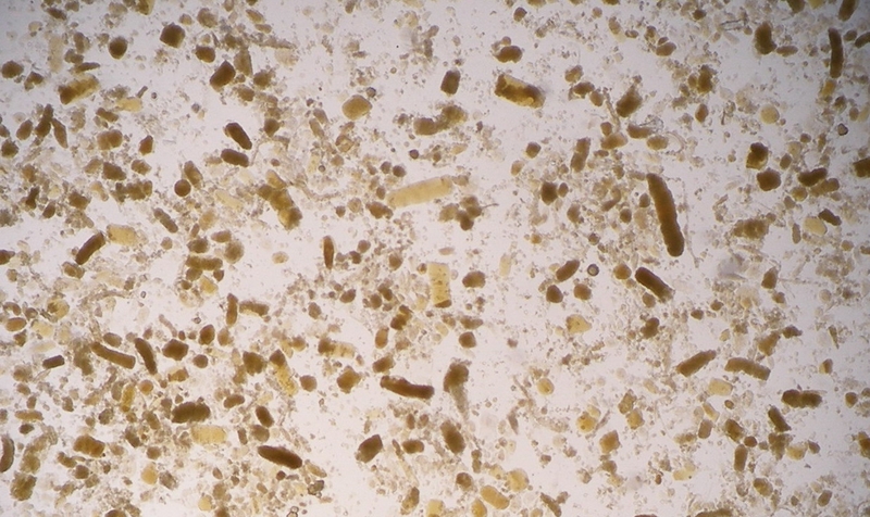 Hoại tử ống thận cấp là gì? Những vấn đề cần biết về Hoại tử ống thận cấp 1