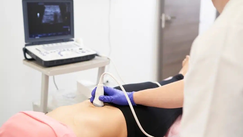 Adenomyosis là bệnh gì? 03