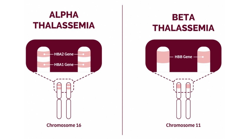 Kiểu gen là yếu tố quan trọng giúp đánh giá mức độ thalassemia