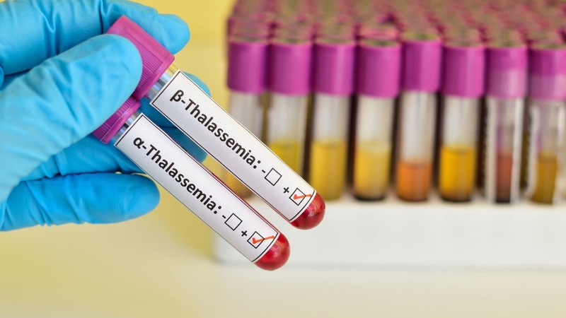 Xét nghiệm di truyền hỗ trợ xác định thể bệnh và nguy cơ di truyền