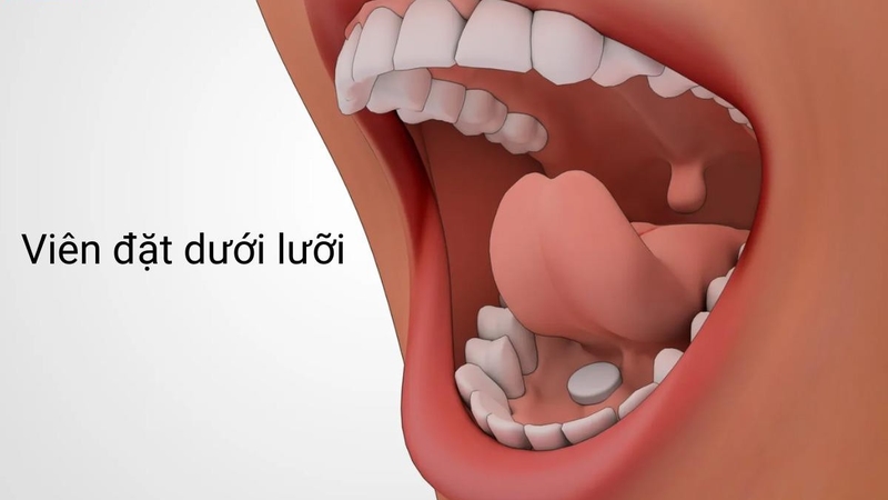 Alprazolam: Công dụng, cách dùng và lưu ý quan trọng 5.jpg