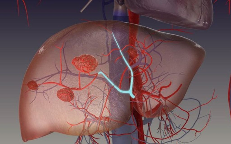 Âm gan tăng là gì, gây nguy hiểm không? Cần làm gì để bảo vệ gan? 1