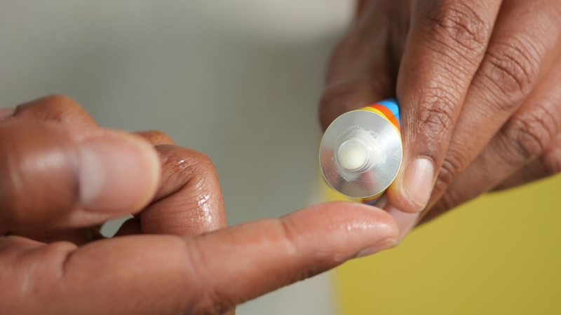 Anthralin được dùng dưới dạng thuốc bôi ngoài