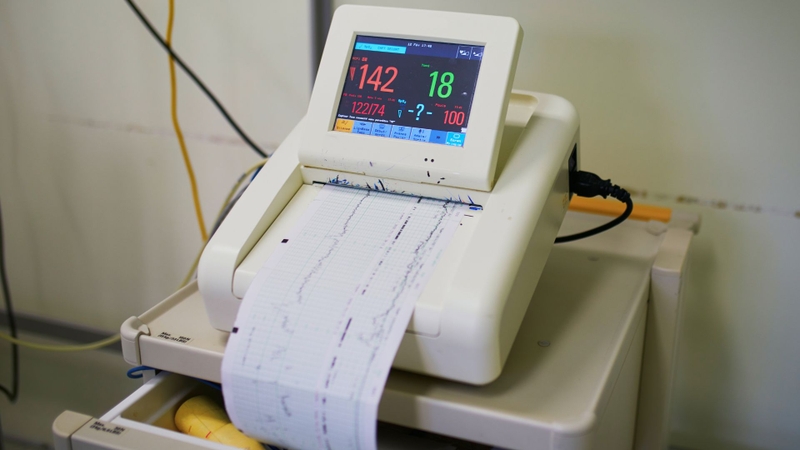 Atosiban không nên sử dụng ở thai nhi có nhịp tim bất thường