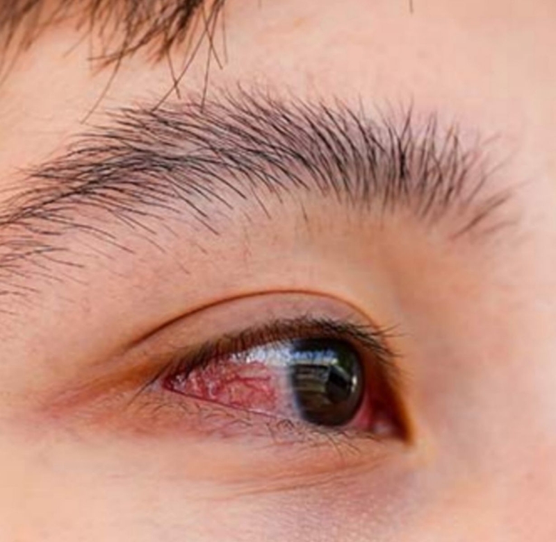 Bà bầu có được dùng thuốc nhỏ mắt rohto không? 4