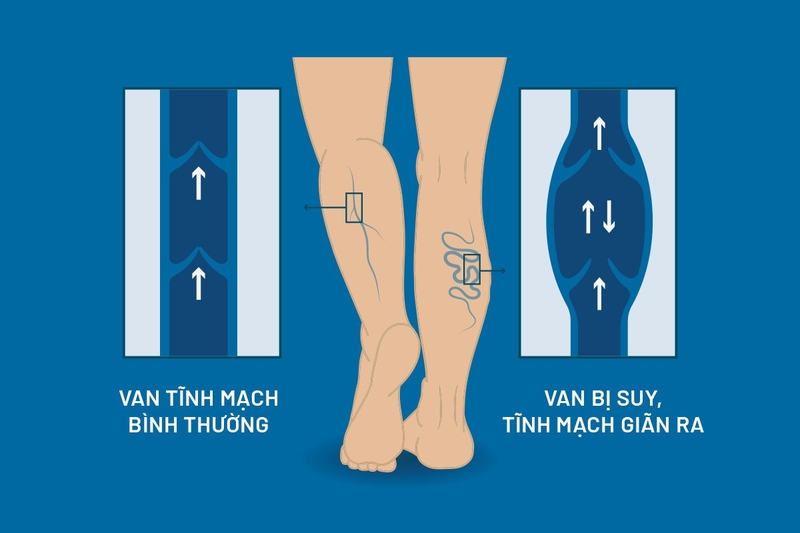 Bài tập thể dục lưu thông khí huyết chân dễ tập và hiệu quả 1