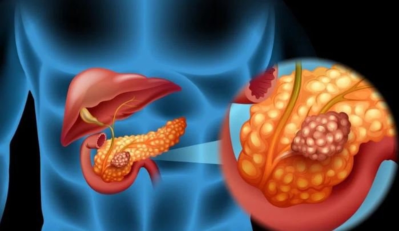 Bạn đã bị ngộ độc paracetamol nếu như có các triệu chứng sau 2