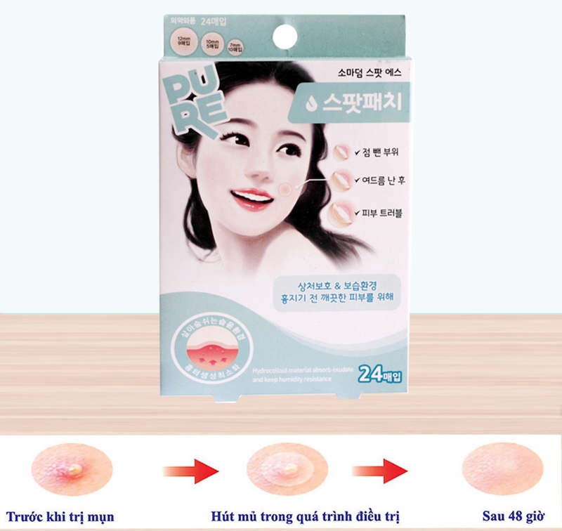 Bật mí các phương pháp trị mụn tại nhà hiệu quả 3