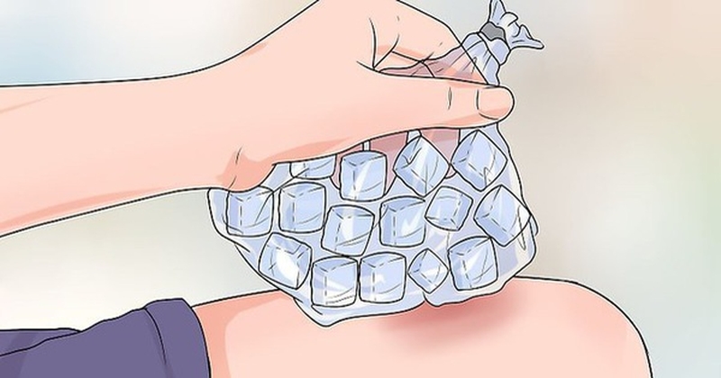 Bật mí cho bạn mẹo dân gian chữa đau thần kinh tọa cực uy tín 2