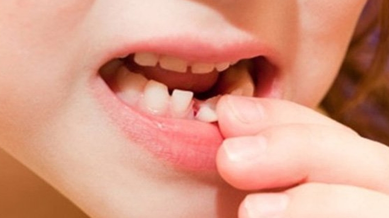 be-bi-nga-lung-lay-rang-sua-nen-lam-gi 2