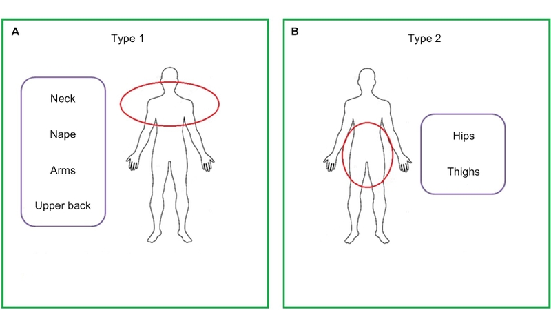 Bệnh Madelung và những điều cần biết 1.jpeg