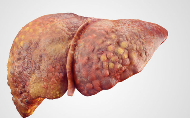 benh-gan-co-lay-khong-cac-van-de-lien-quan-den-gan 1