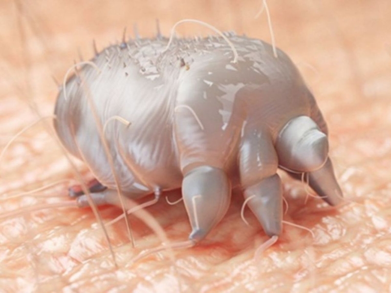 Ghẻ nước là bệnh gì? Bệnh ghẻ nước có lây không 1