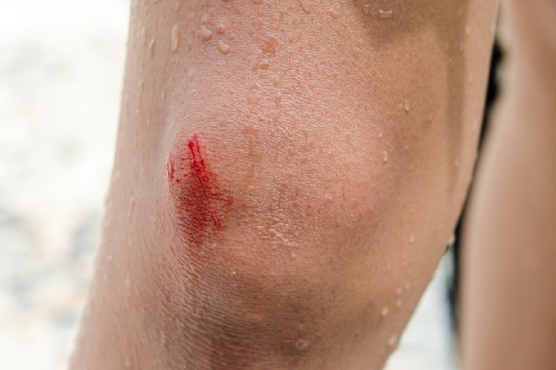 Bệnh lậu lây qua những đường nào? Bệnh lậu có lây qua quần áo không? 2