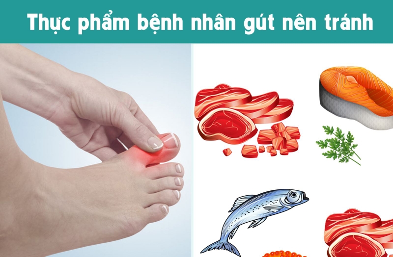 Bệnh nhân Gout có uống nước yến hoặc ăn tổ yến được không 2