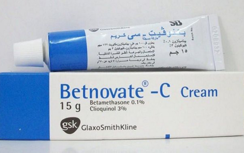 Benh-vay-nen-hong-co-lay-khong (4).png