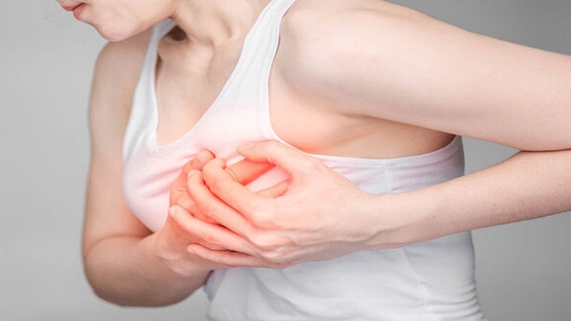 Nổi cục ở nhũ hoa: Dấu hiệu u lành tính và u ác tính 2