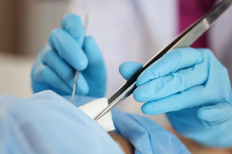 Xơ cứng bì là gì? Bệnh xơ cứng bì sống được bao lâu 3