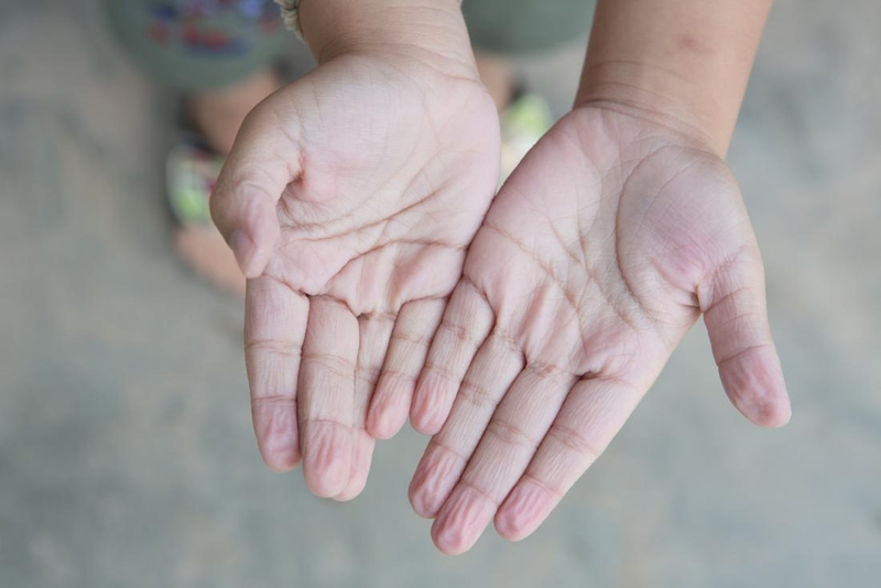 Bí quyết chăm sóc đôi tay khi đeo găng tay y tế trong thời gian dài 1