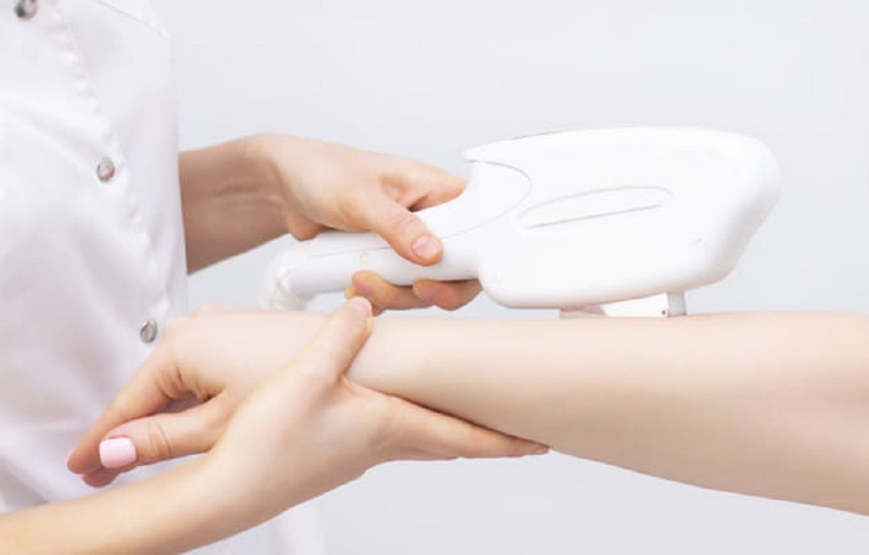 Bỏ túi thông tin từ A-Z về triệt lông 1