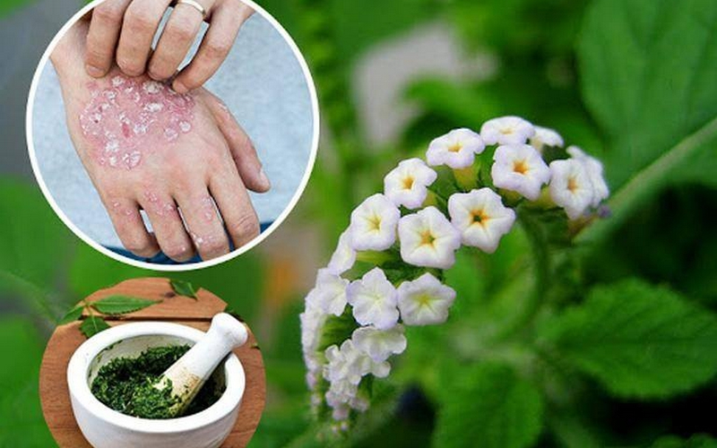 Cac-bai-thuoc-dan-gian-dung-cay-voi-voi-chua-vay-nen (2).png