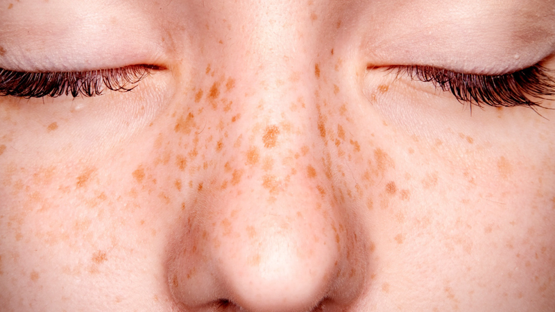 Các dấu hiệu cảnh báo da đang hư tổn và xuống cấp trầm trọng 1