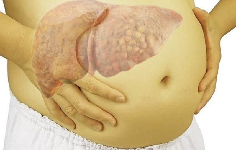 cac-dau-hieu-gan-khong-tot-va-cach-phong-ngua 4