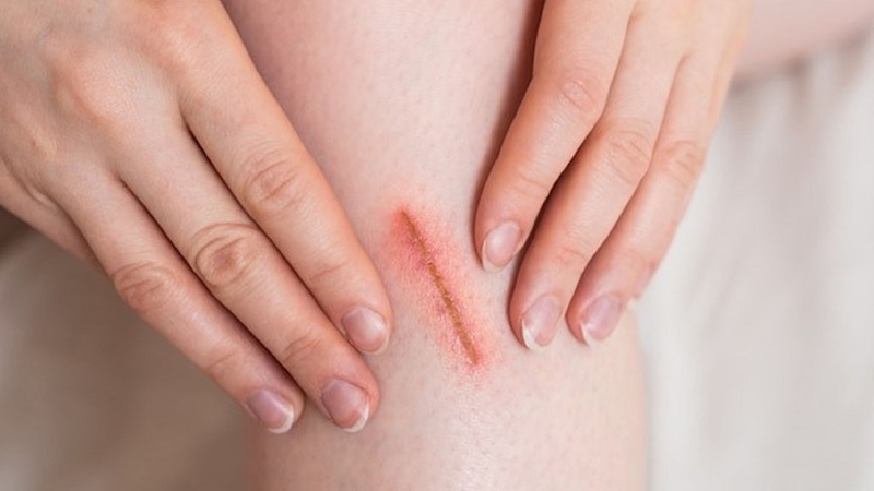 Các dấu hiệu tiểu đường trên da bạn không nên bỏ qua 3