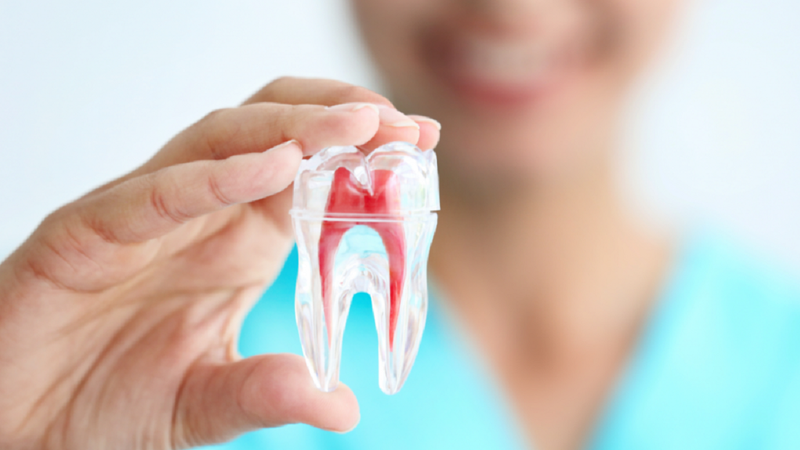 Cách trị sâu răng tận gốc: loại bỏ tuỷ để giữ lại răng