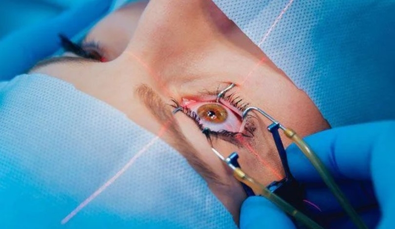 Các tật của mắt 03