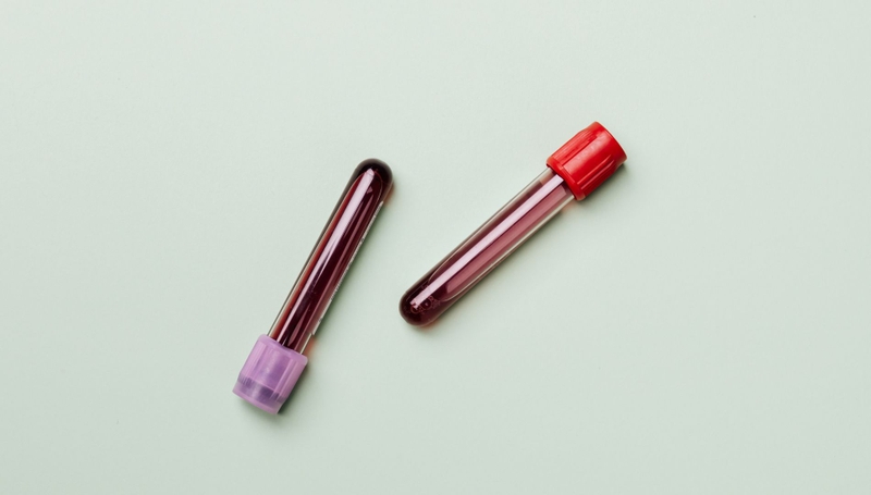 Các xét nghiệm nên thực hiện trước khi kết hôn là gì? 2