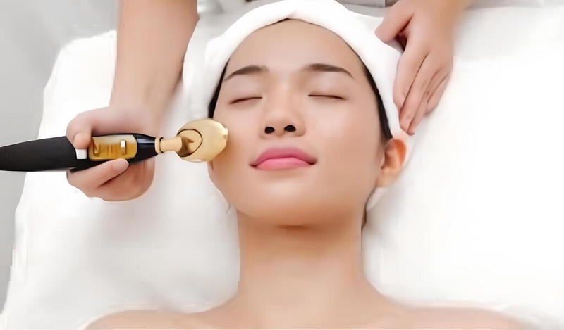 Cách chăm sóc da sau khi bắn than hoạt tính đơn giản ngay tại nhà 3