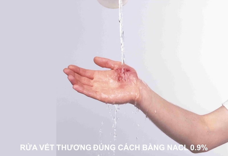Cách làm vết thương hở mau lành, không để lại sẹo ngay tại nhà 1