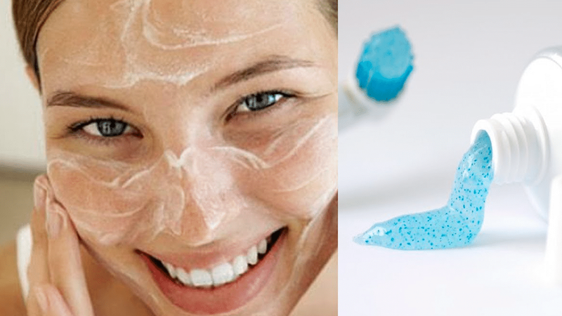 Cách lột mụn đầu đen bằng kem đánh răng cực đơn giản 1