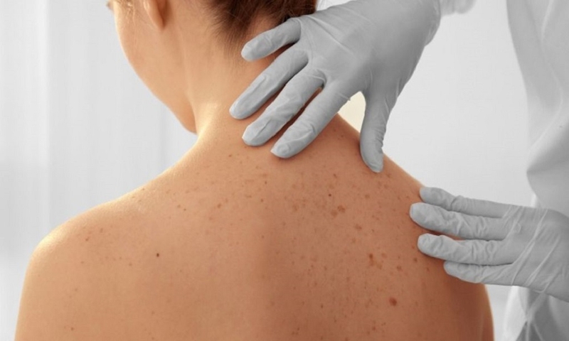 Cách sử dụng cây hương thảo đuổi hiệu quả 4