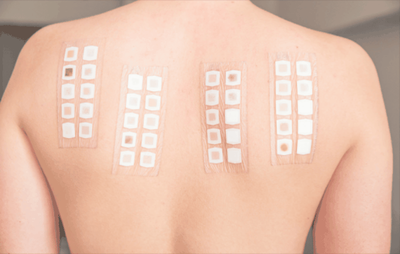 Cách xử lý khi bị dị ứng sữa tắm 3.png