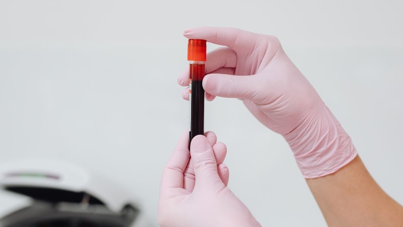 Xét nghiệm máu giúp đánh giá nồng độ calcitonin trong cơ thể