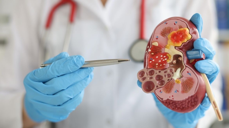 Calcium glucoheptonate là gì? Công dụng, cách dùng và những lưu ý quan trọng 7.jpg