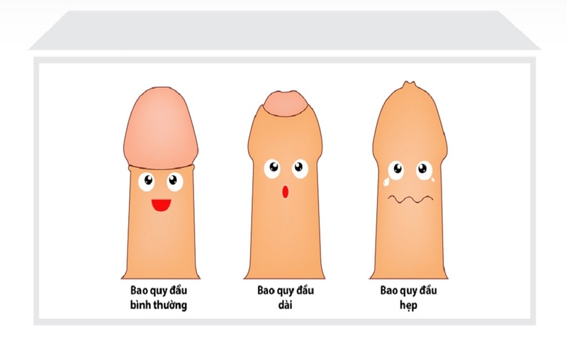 Cắt bao quy đầu bao lâu thì lành? Những lưu ý sau cắt bao quy đầu 1